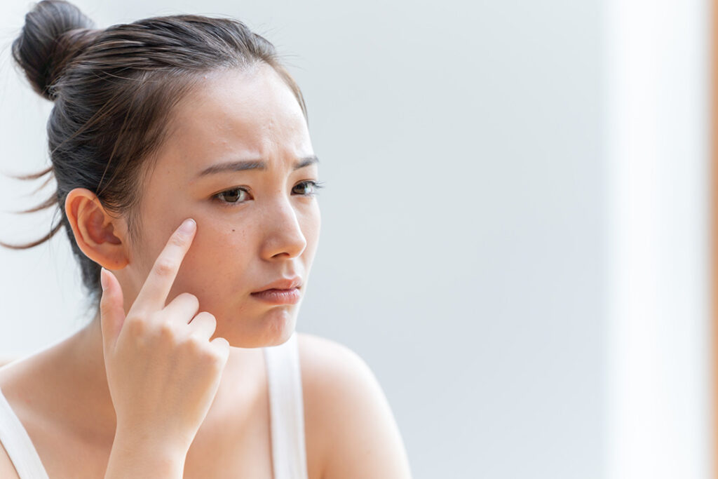 肌の状態を気にする女性